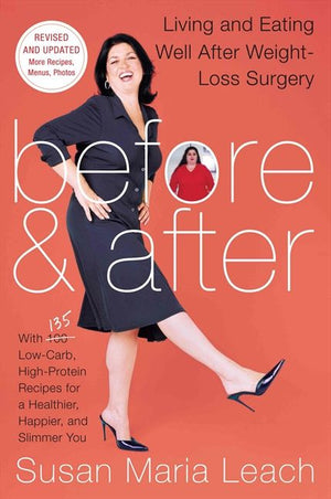 Before & After, Second Revised Edition (9780062239990)